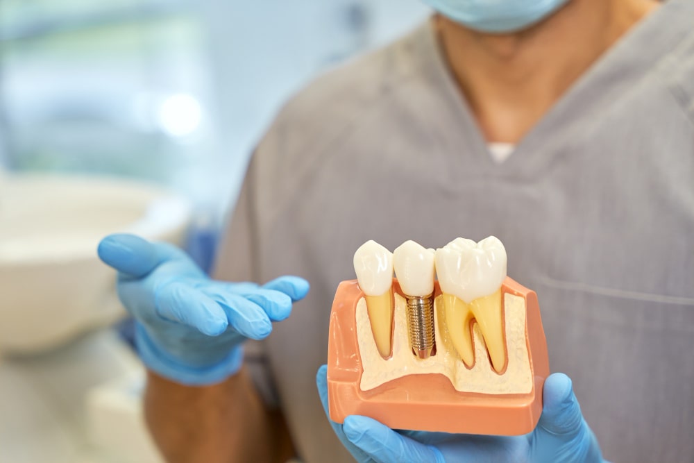 Implantologie dentară